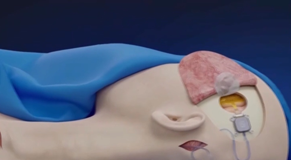 Mind-control breakthrough in China